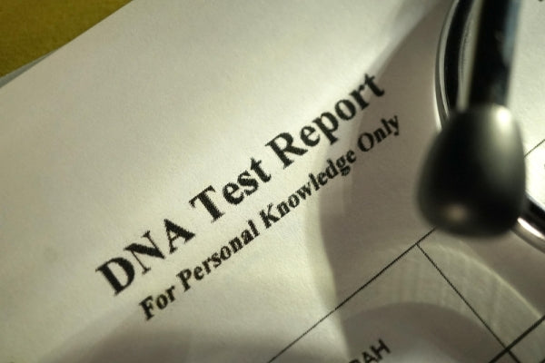 人間のサンプルを犬と誤って識別したペットの遺伝子検査会社が非難されている